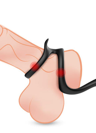 Penis ring with perianal stimulation